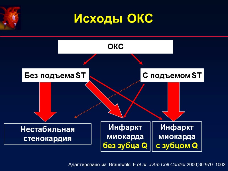 Исходы ОКС ОКС Без подъема ST С подъемом ST Нестабильная стенокардия Инфаркт миокарда Исходы ОКС ОКС Без подъема ST С подъемом ST Нестабильная стенокардия Инфаркт миокарда